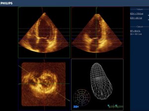 Ecografia cardiaca